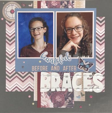Braces
